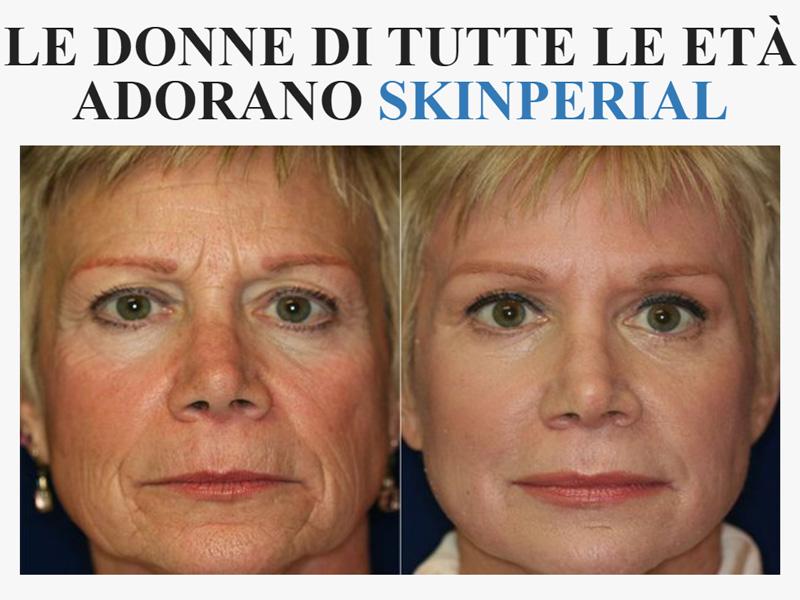 SkinPerial: Il Segreto per una Pelle Giovane e Luminosa